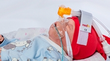 اهدای سه عدد، ماسک ومینی فلو N-CPAP، 